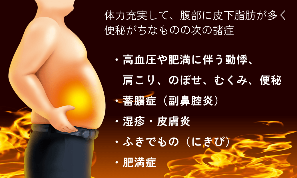 防風通聖散エキスZ錠 クラシエ 330錠 【第2類医薬品】 | カワチ薬品